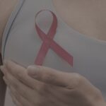 Areola & Nipple Tattooing in Port Moody, BC