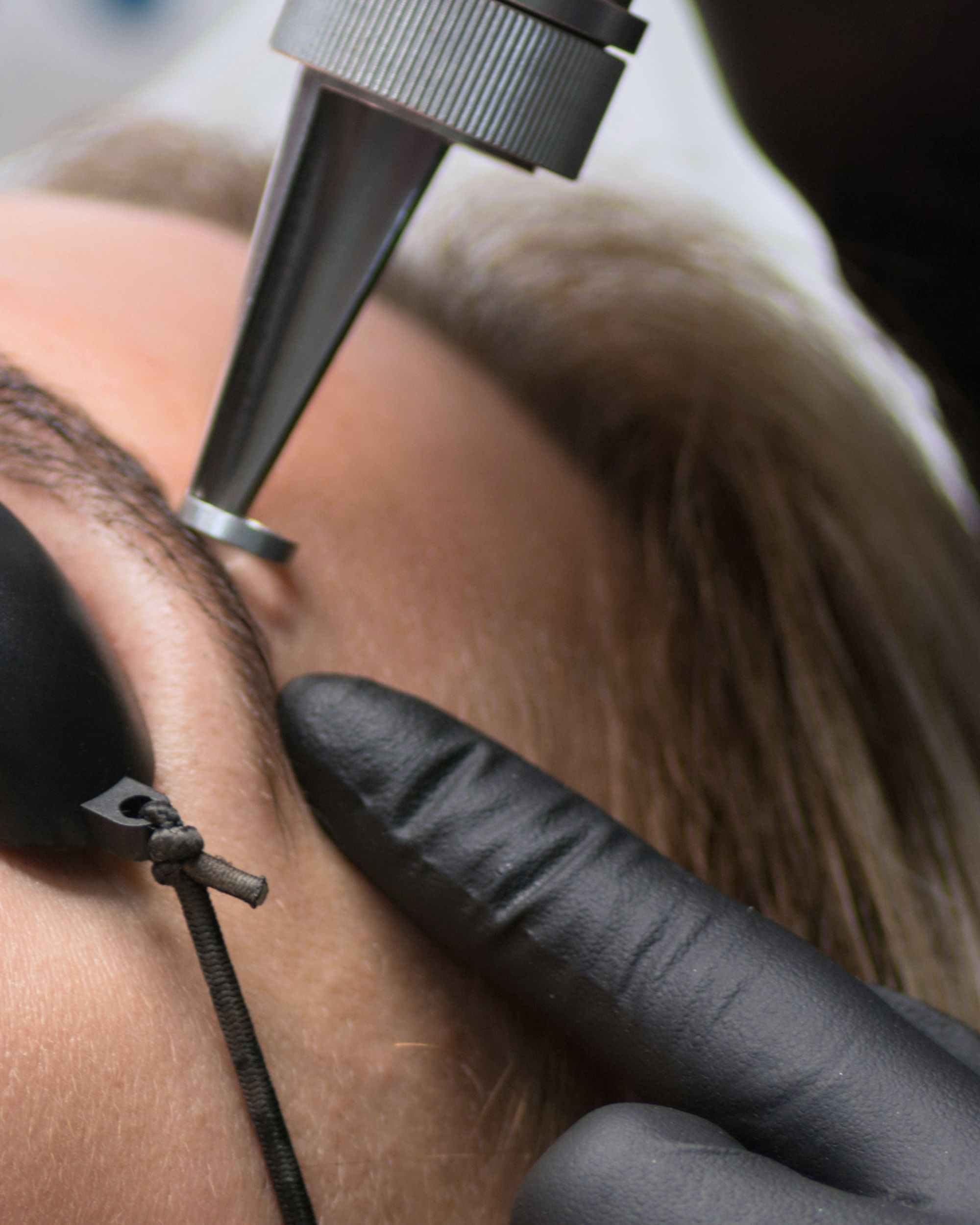 laser microblading removal in a private Port Moody studio